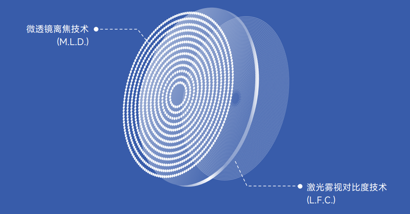 近視防控新選擇：鏡小昔Ultra雙效合一，開啟護眼新時代